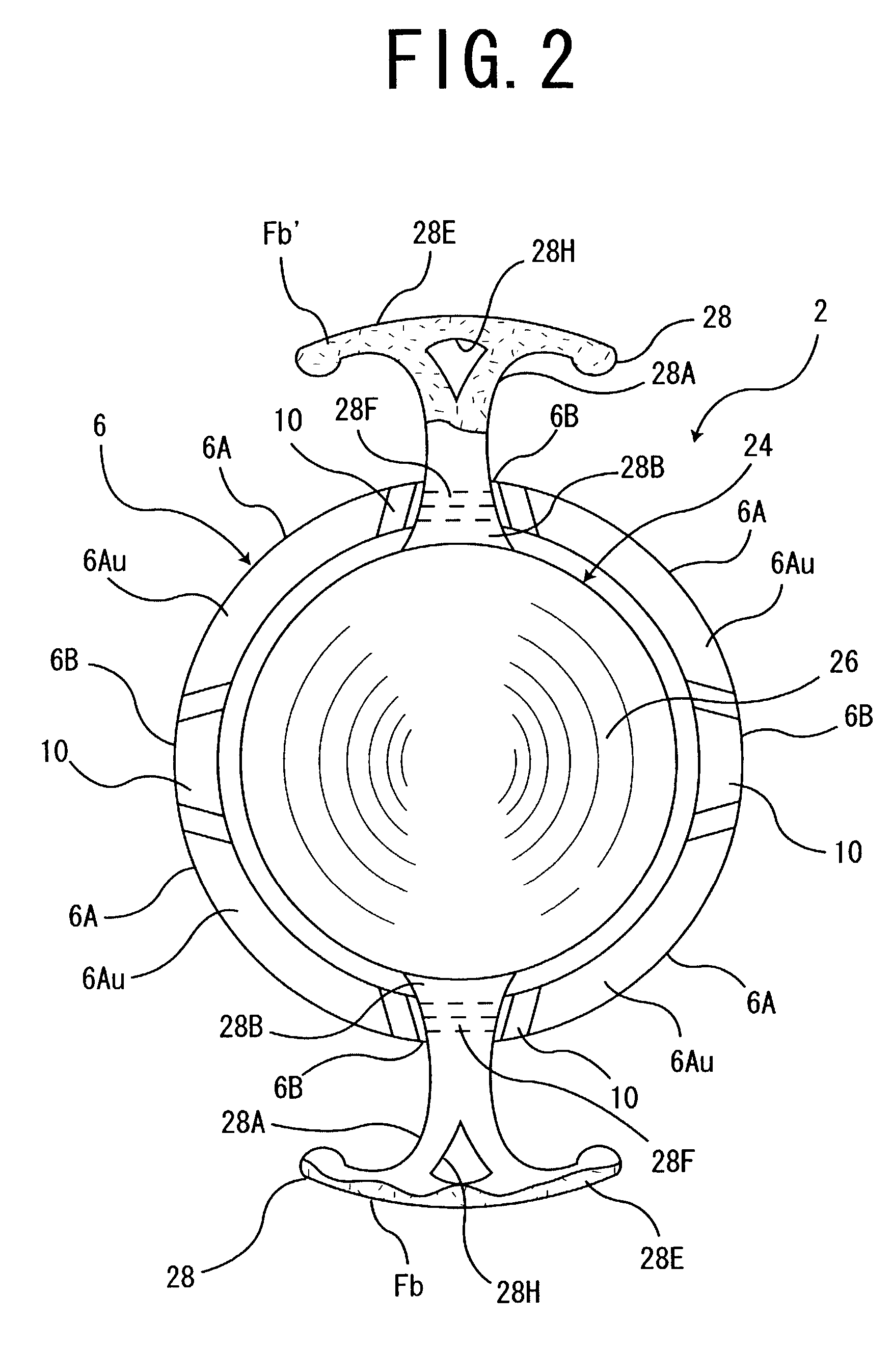 Intraocular ring assembly and artificial lens kit