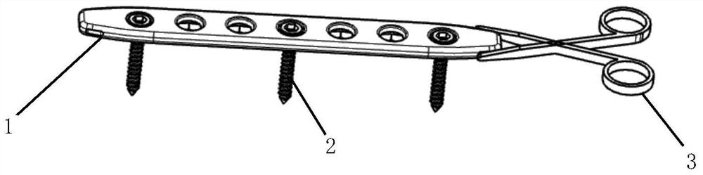 A kind of internal fixation system and using method thereof