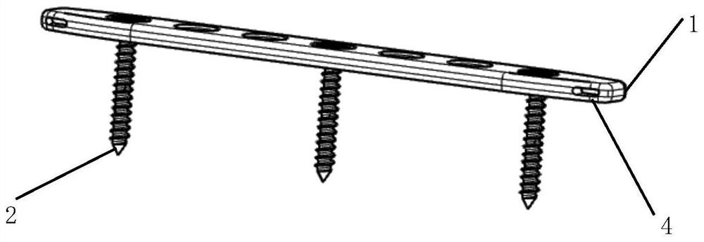 A kind of internal fixation system and using method thereof