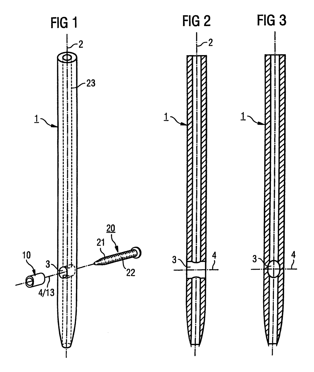 Surgical nail