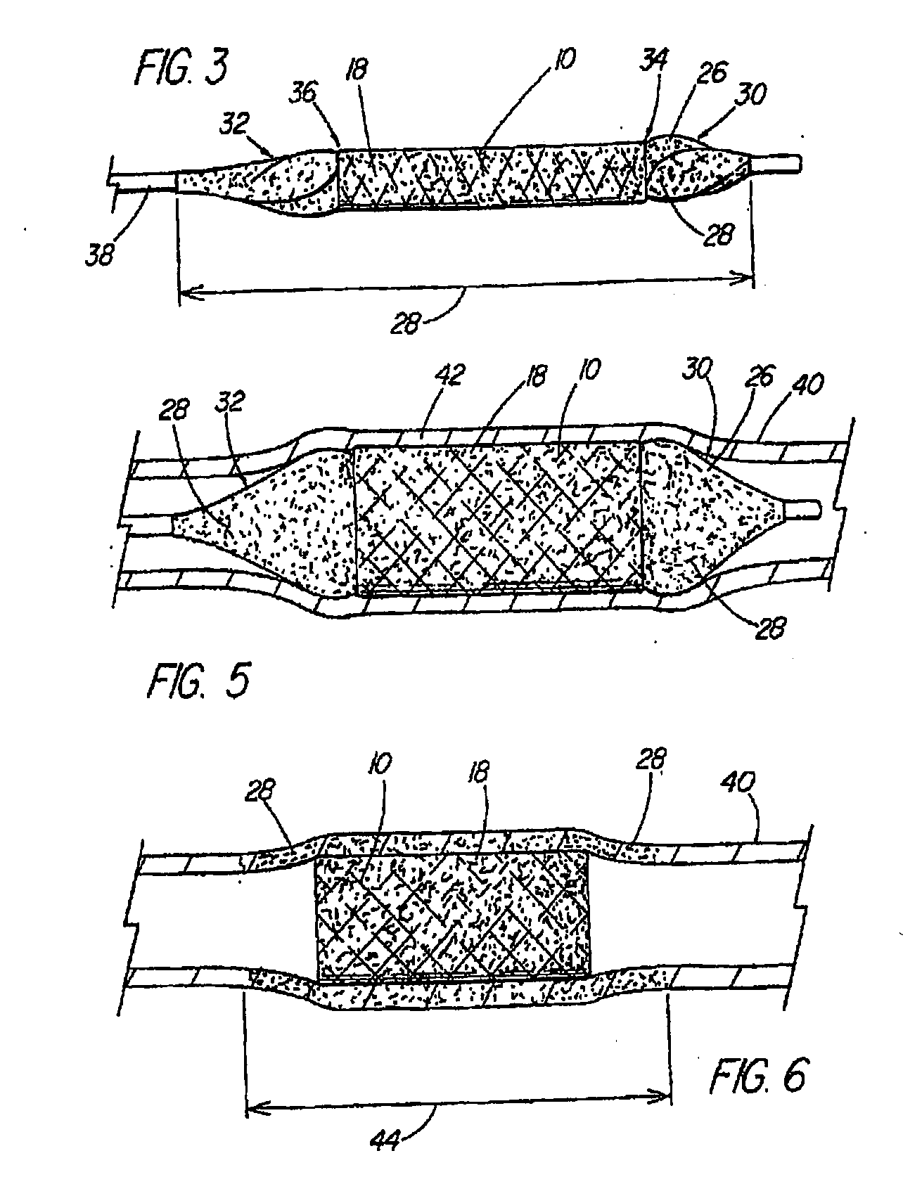 Coated medical device