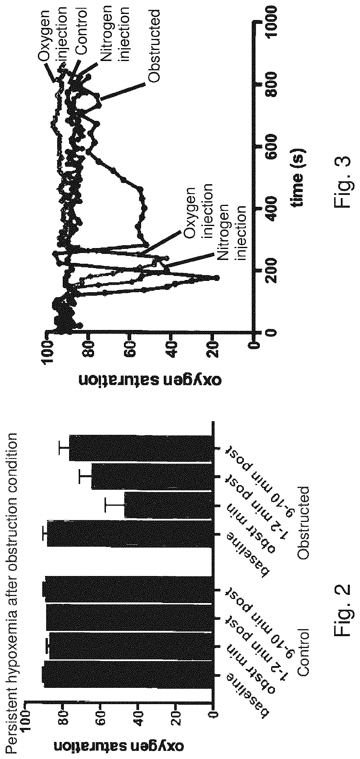 Acute pulmonary pressurization device and method of use