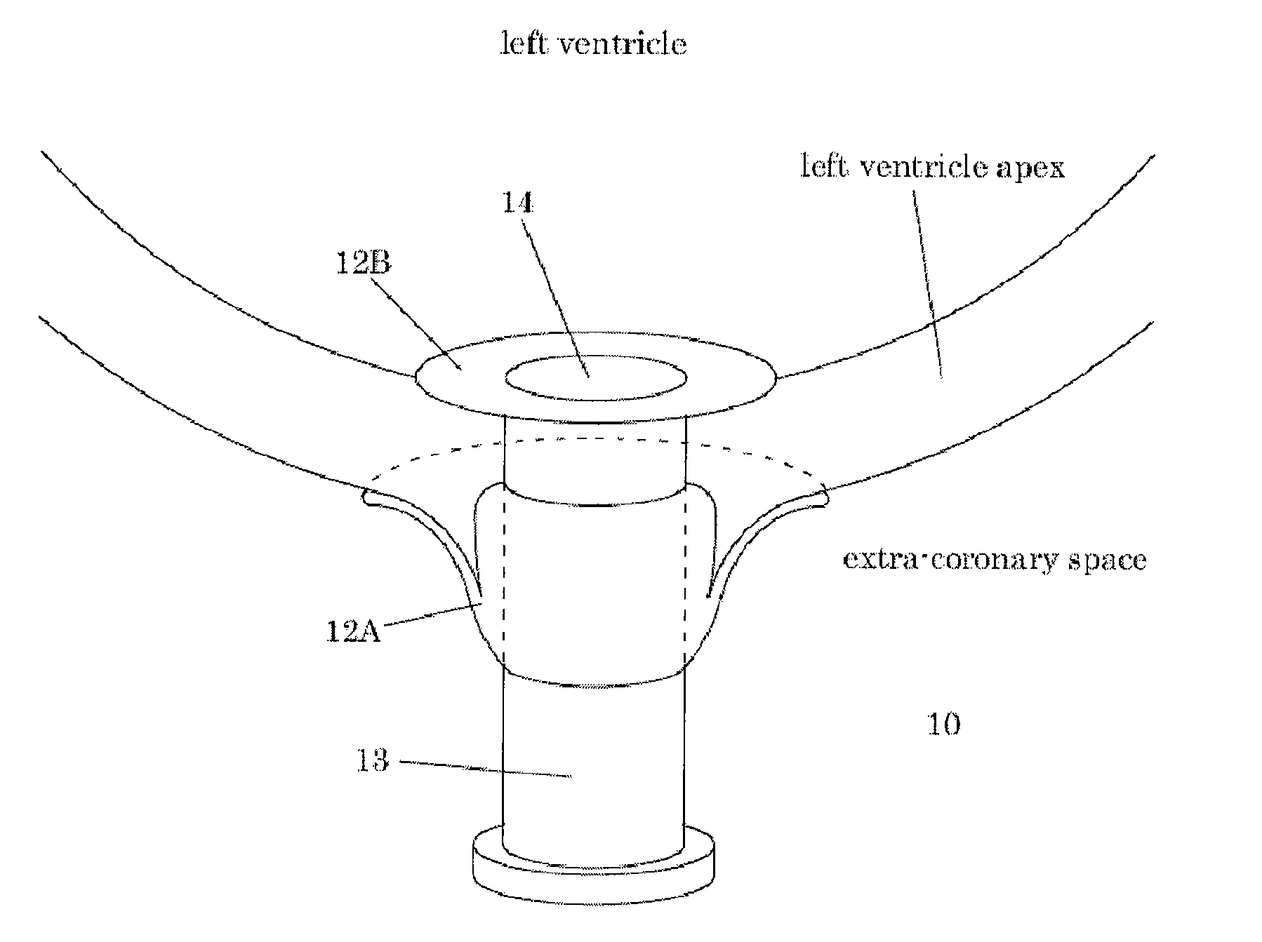 Devices and methods for percutaneous access, hemostasis, and closure