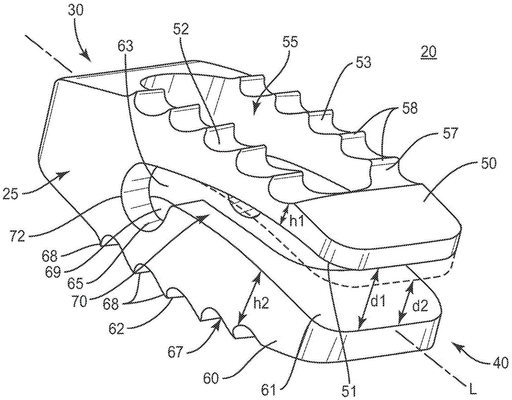 Adaptable interbody implant and methods of use