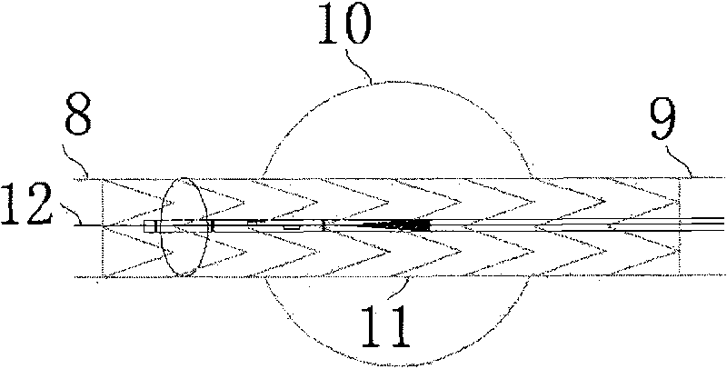 Sacculus conveyer