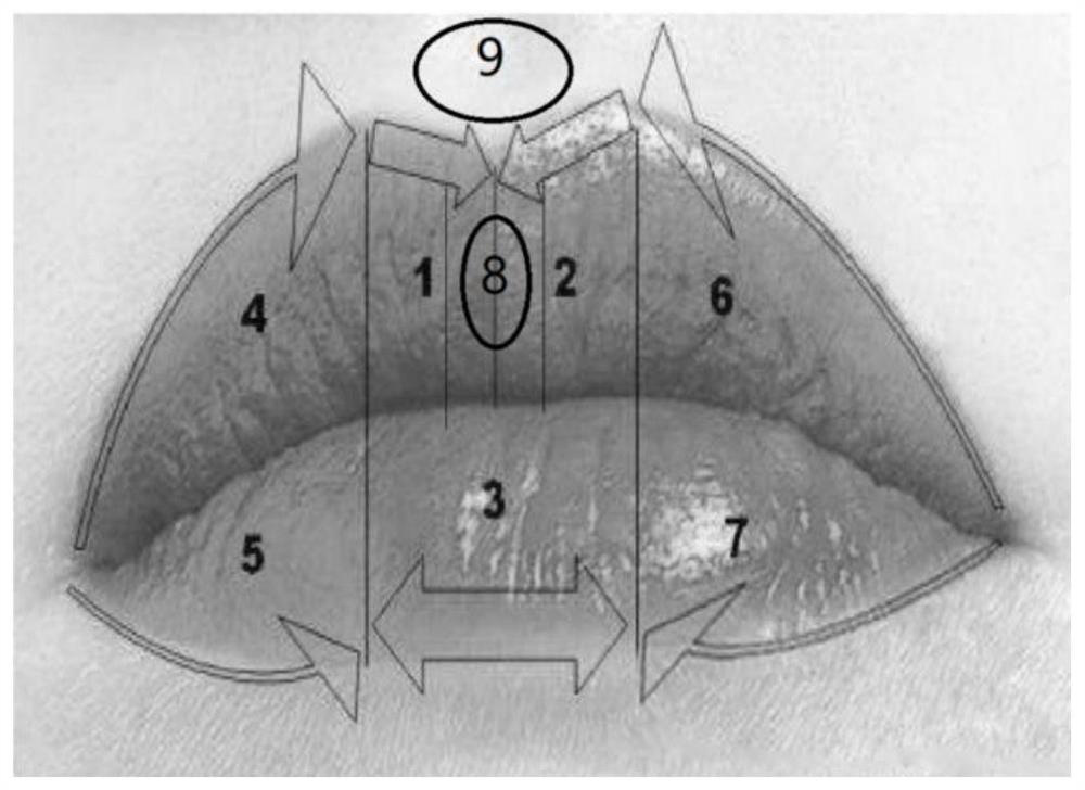 Non-invasive lip beautifying method