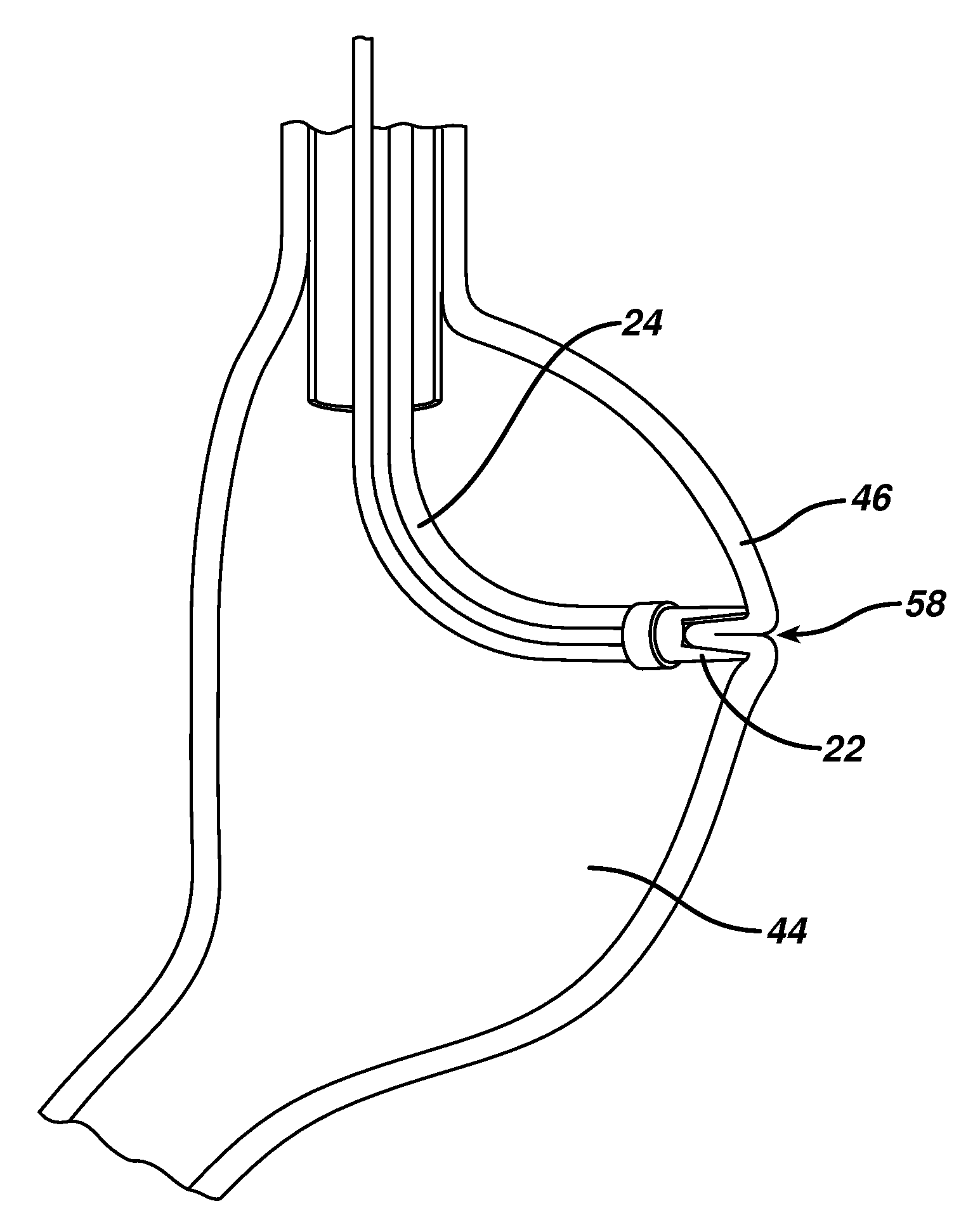 Method for plicating and fastening gastric tissue