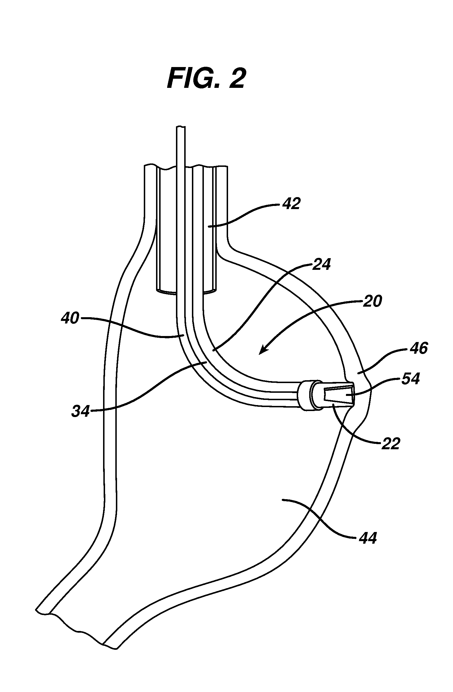 Method for plicating and fastening gastric tissue