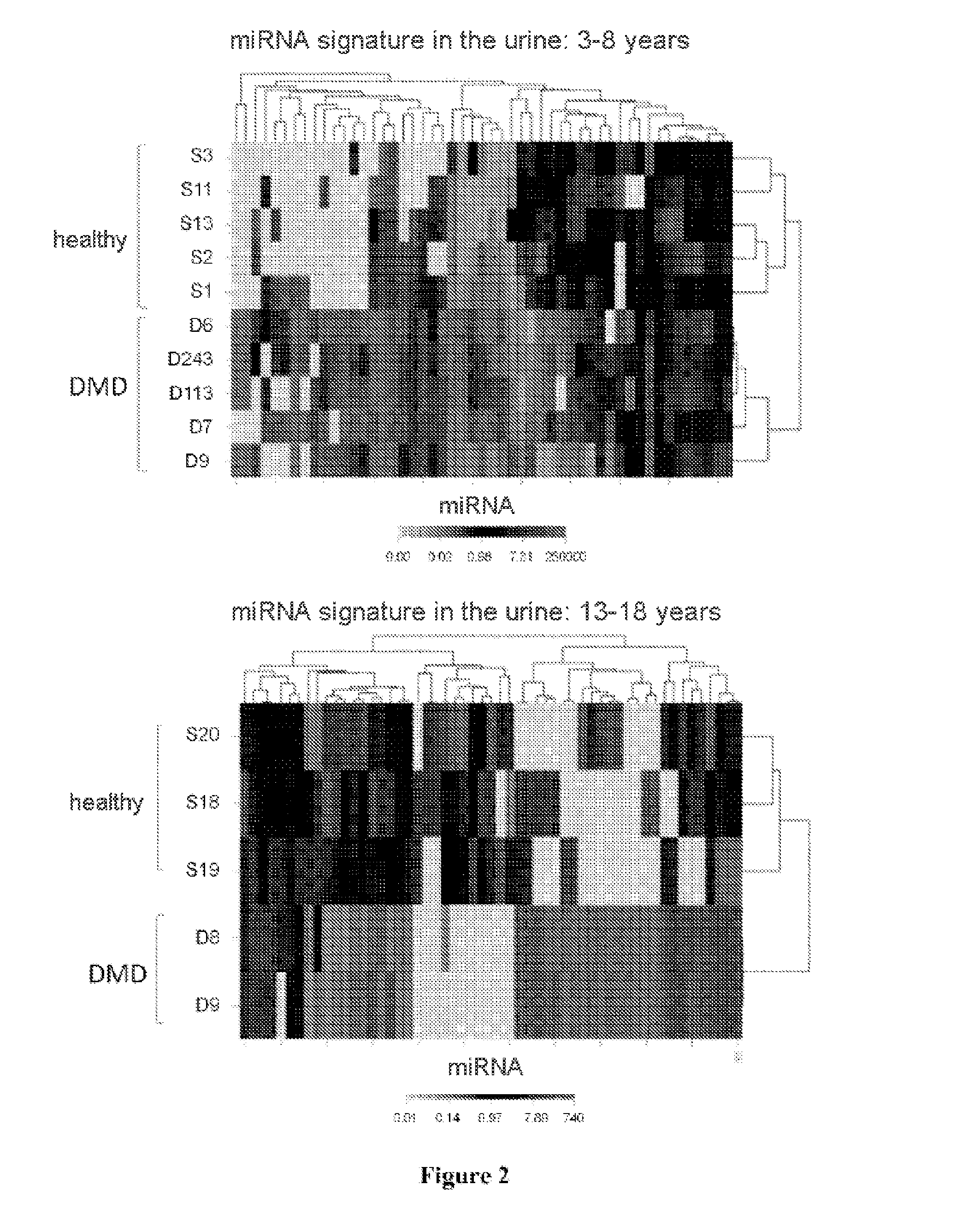 Methods for diagnosis and therapeutic follow-up of muscular dystrophies