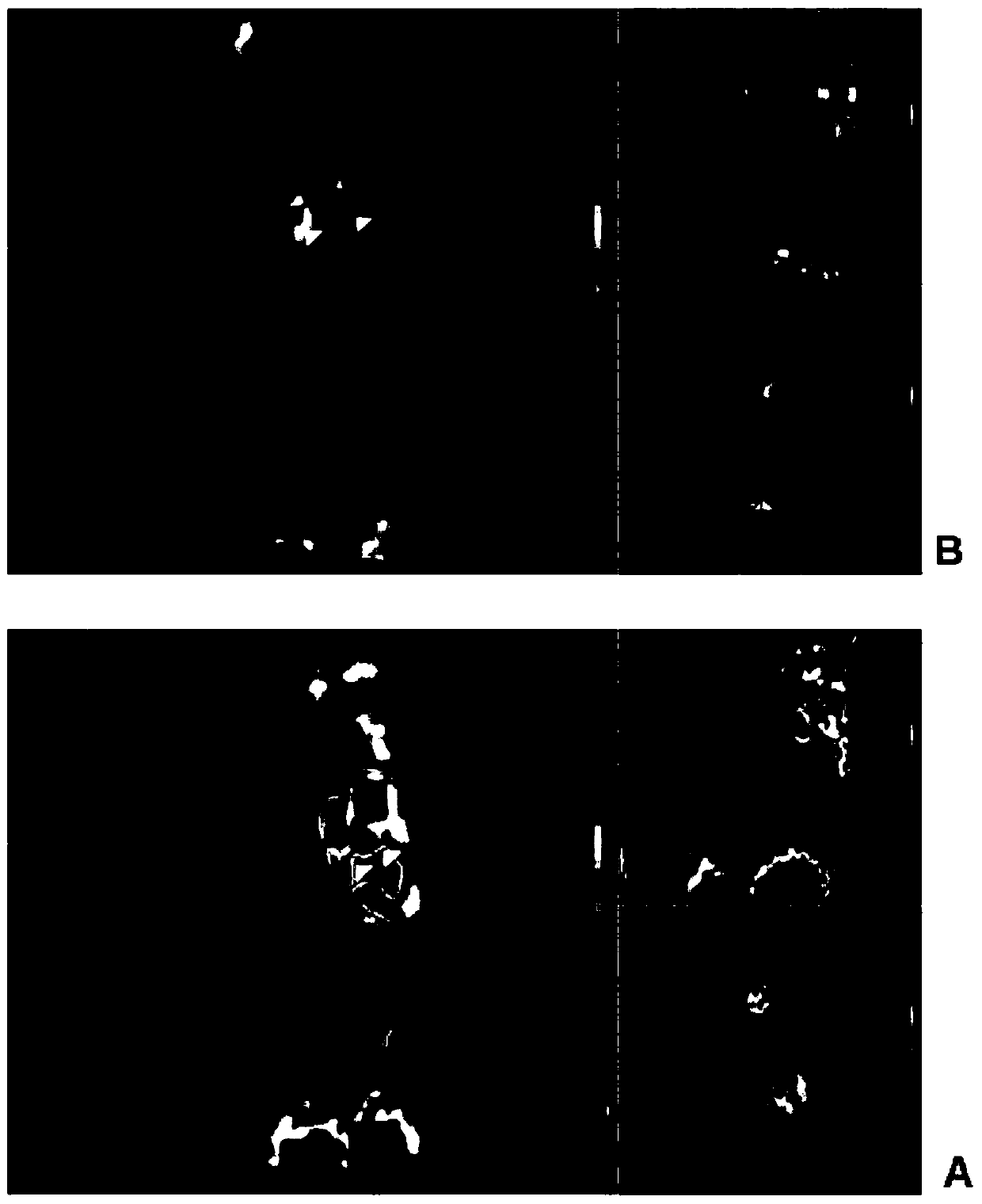 Establishing method of rat atrial fibrillation model for simulating characteristics of human diseases