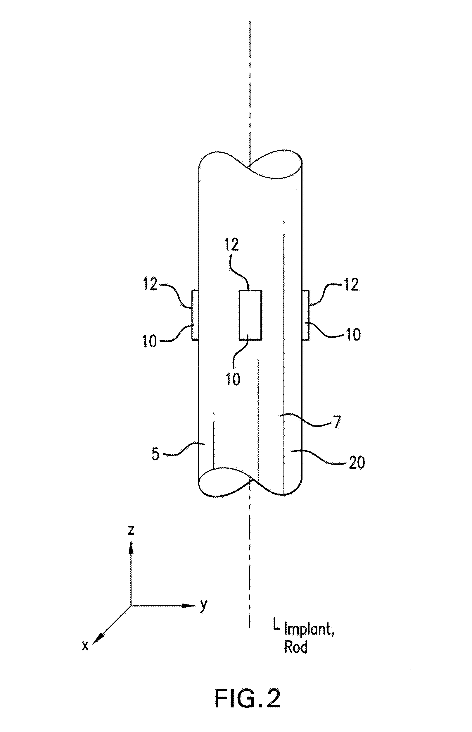 Strain monitoring system and apparatus