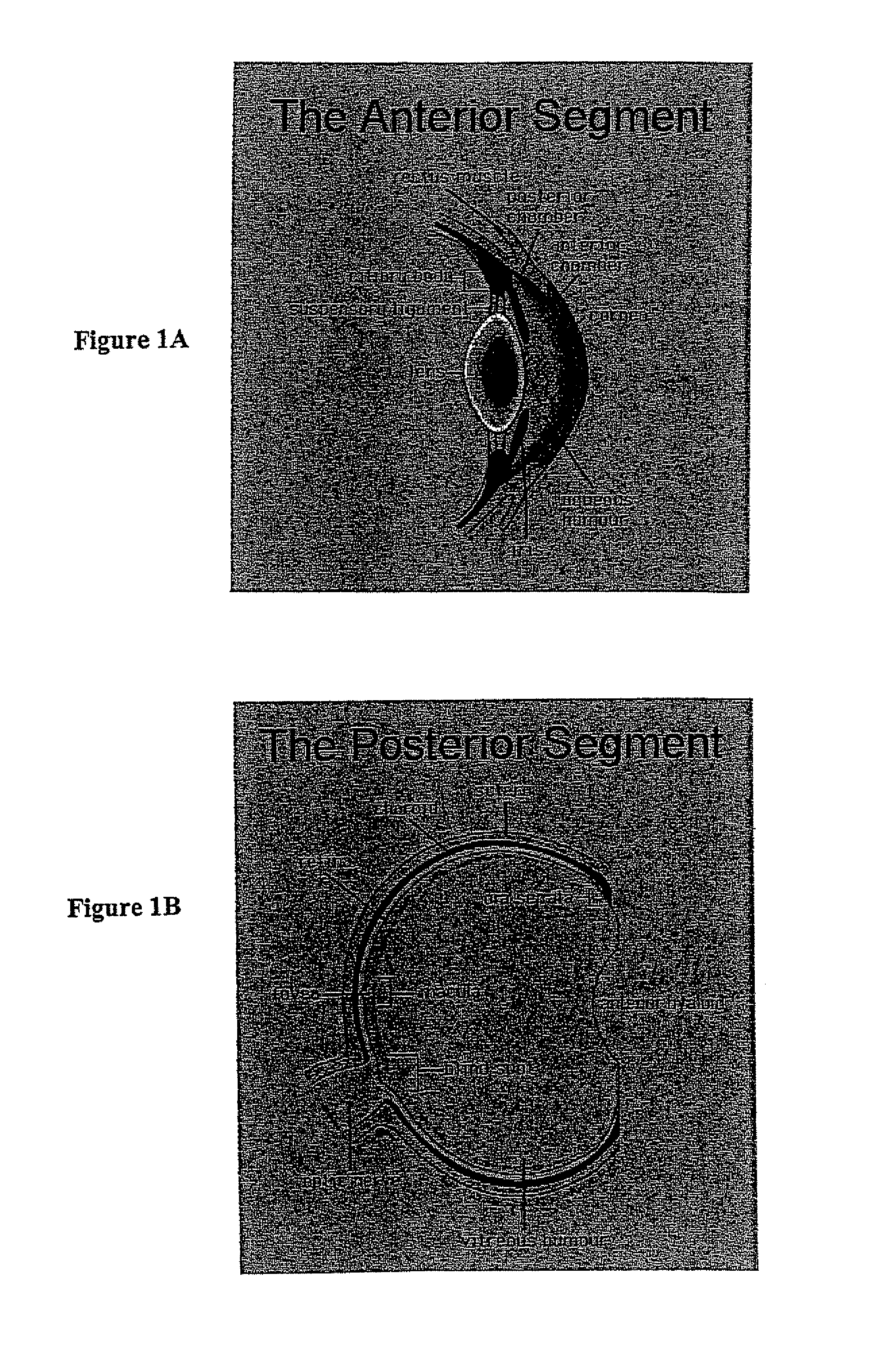 Viral complement control proteins for eye disorders