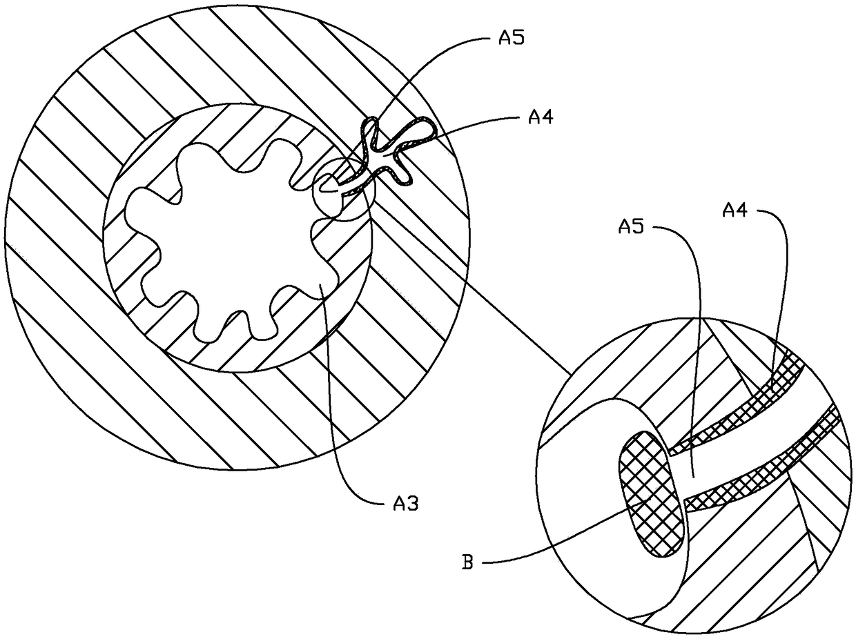 Device acting on anal sinuses