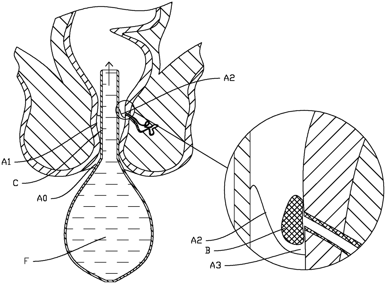 Device acting on anal sinuses