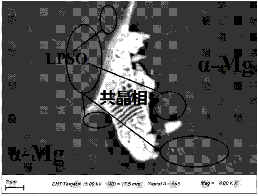 mg-gd-zn(-ca) medical magnesium alloy with lpso structure and preparation method thereof