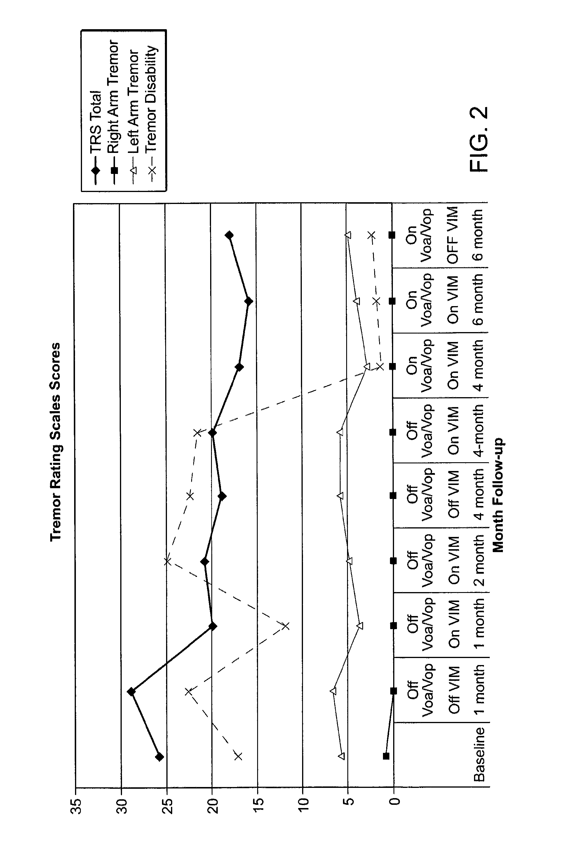 Multiple lead method for deep brain stimulation