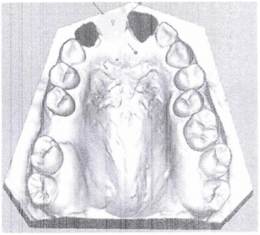 Gingival deformation simulation method based on mass-spring model of long axis of tooth