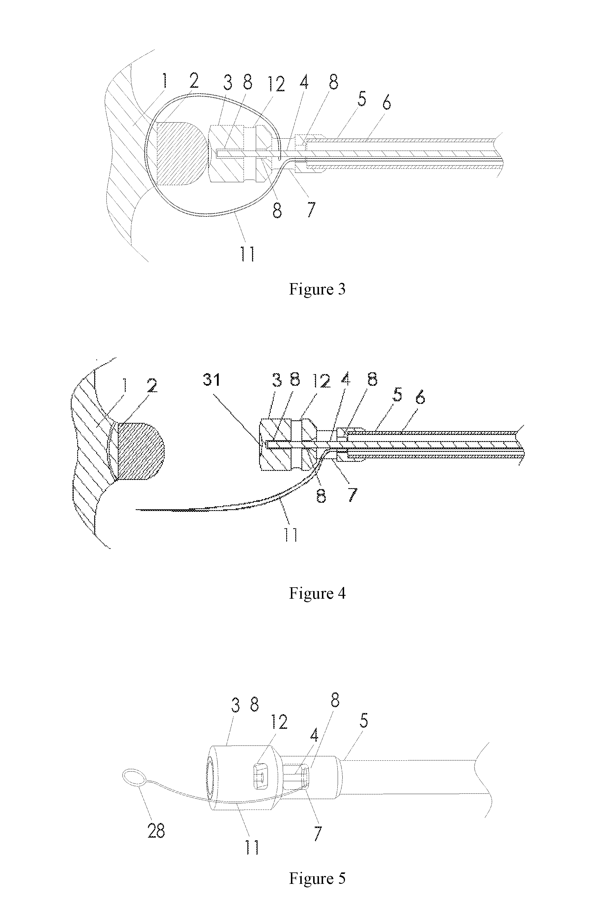 Implant Conveying Device and Implanted Medical Instrument