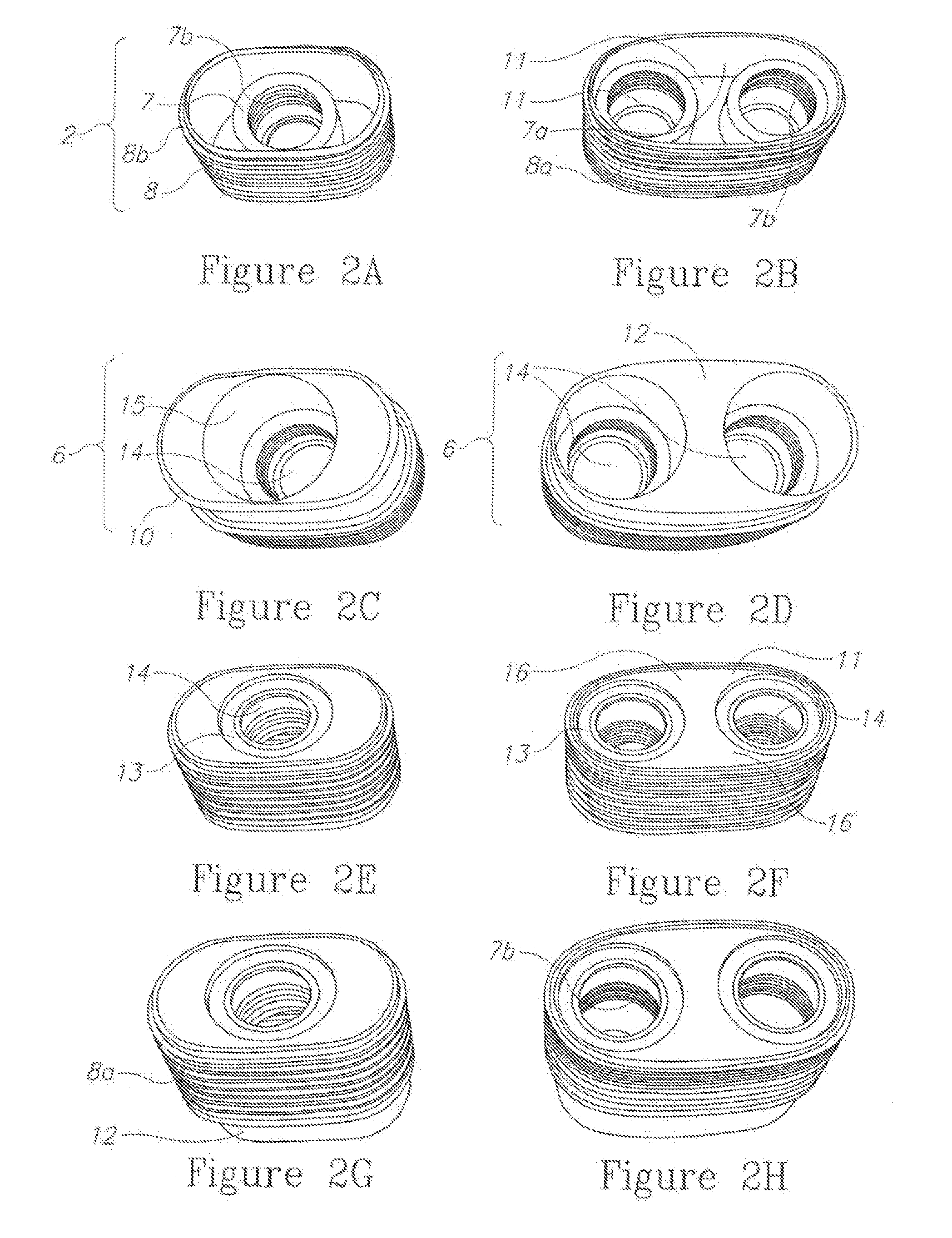 System, method and apparatus for implementing dental implants