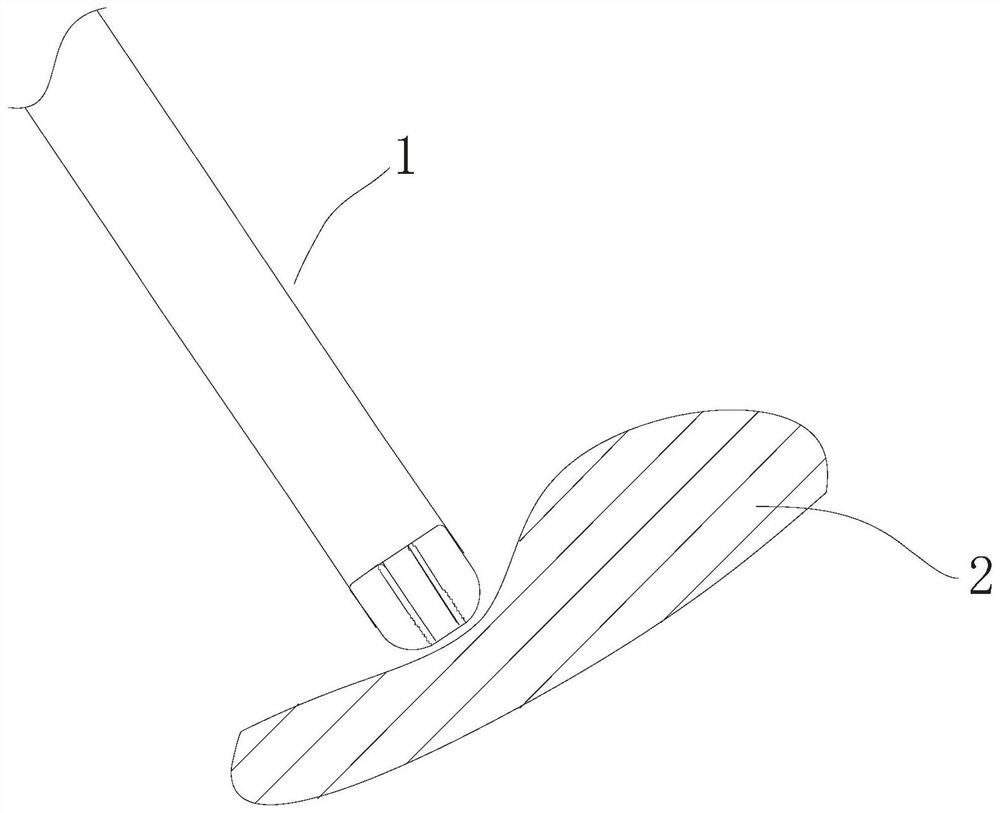 An Interpolar Cryoablation Catheter