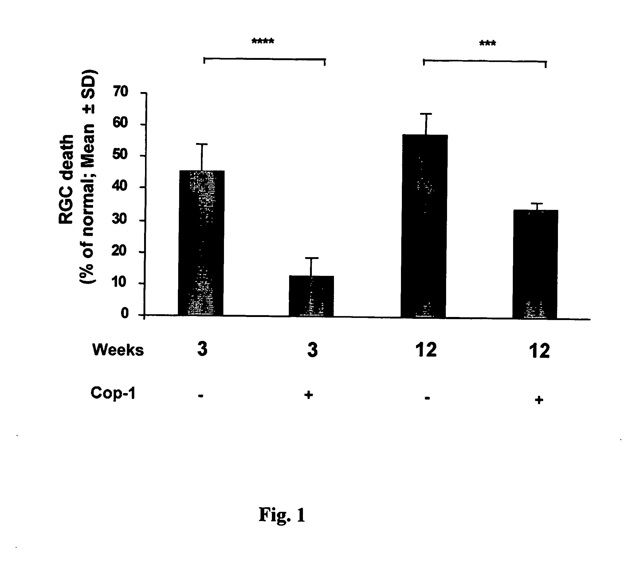 Eye-Drop Vaccine Containing Copolymer 1 for Therapeutic Immunization