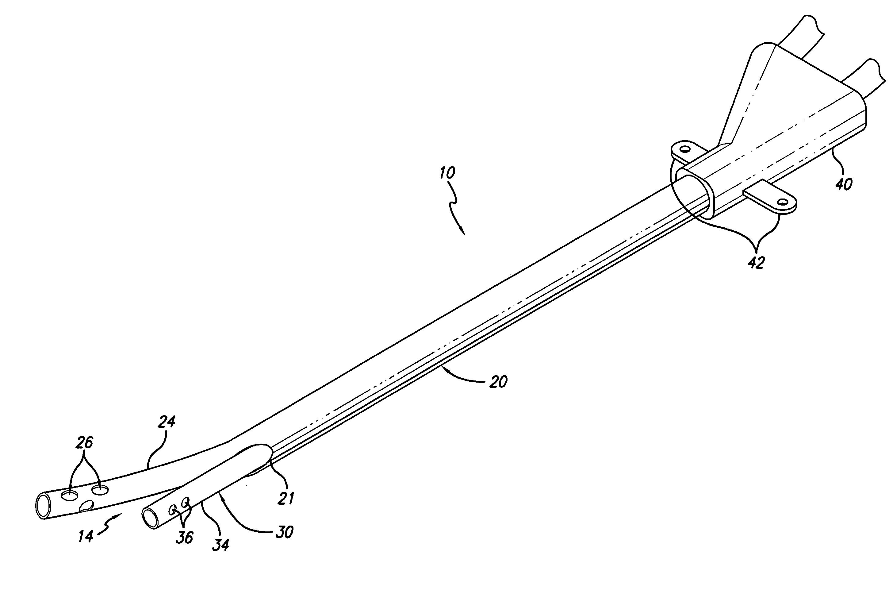 Split tip dialysis catheter