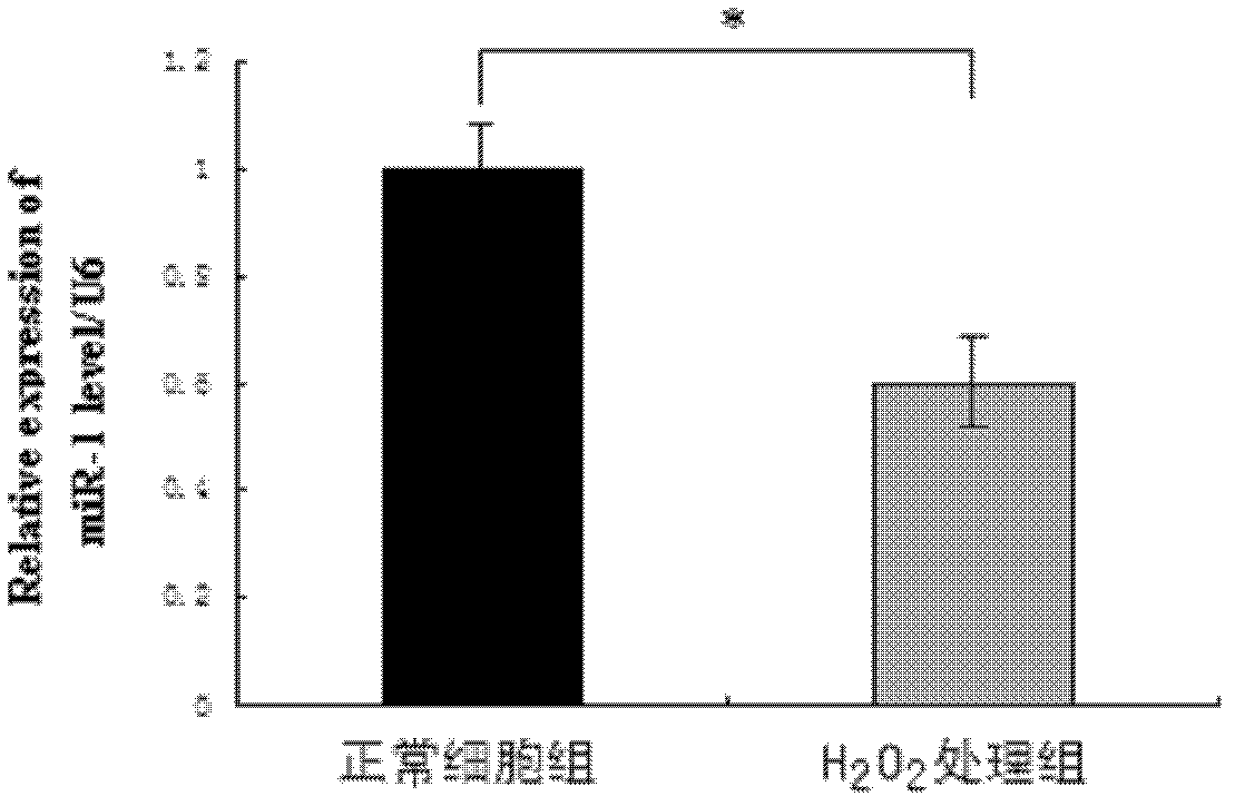 Application of miR-1 in production of preparation for treating primary glaucoma