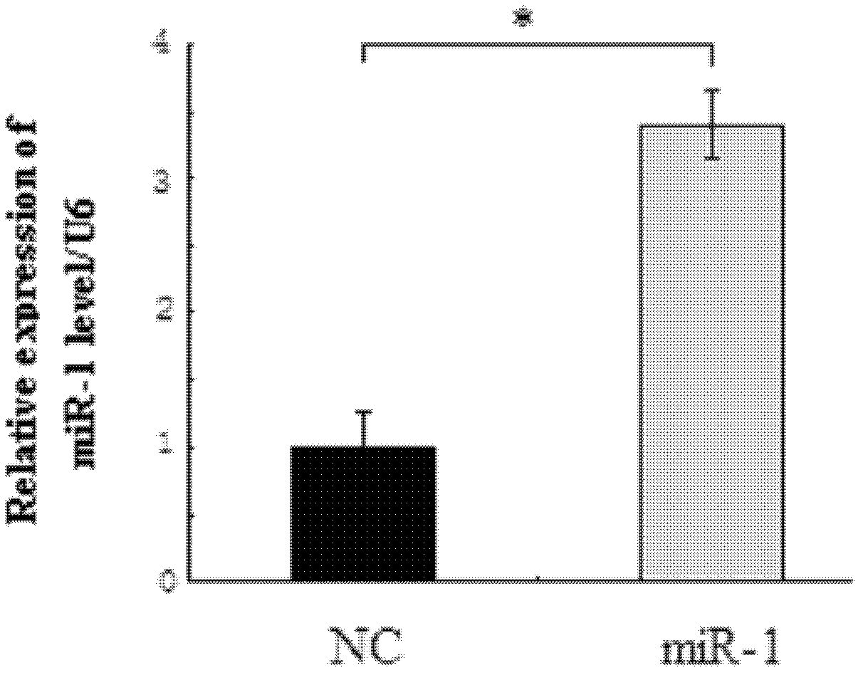 Application of miR-1 in production of preparation for treating primary glaucoma
