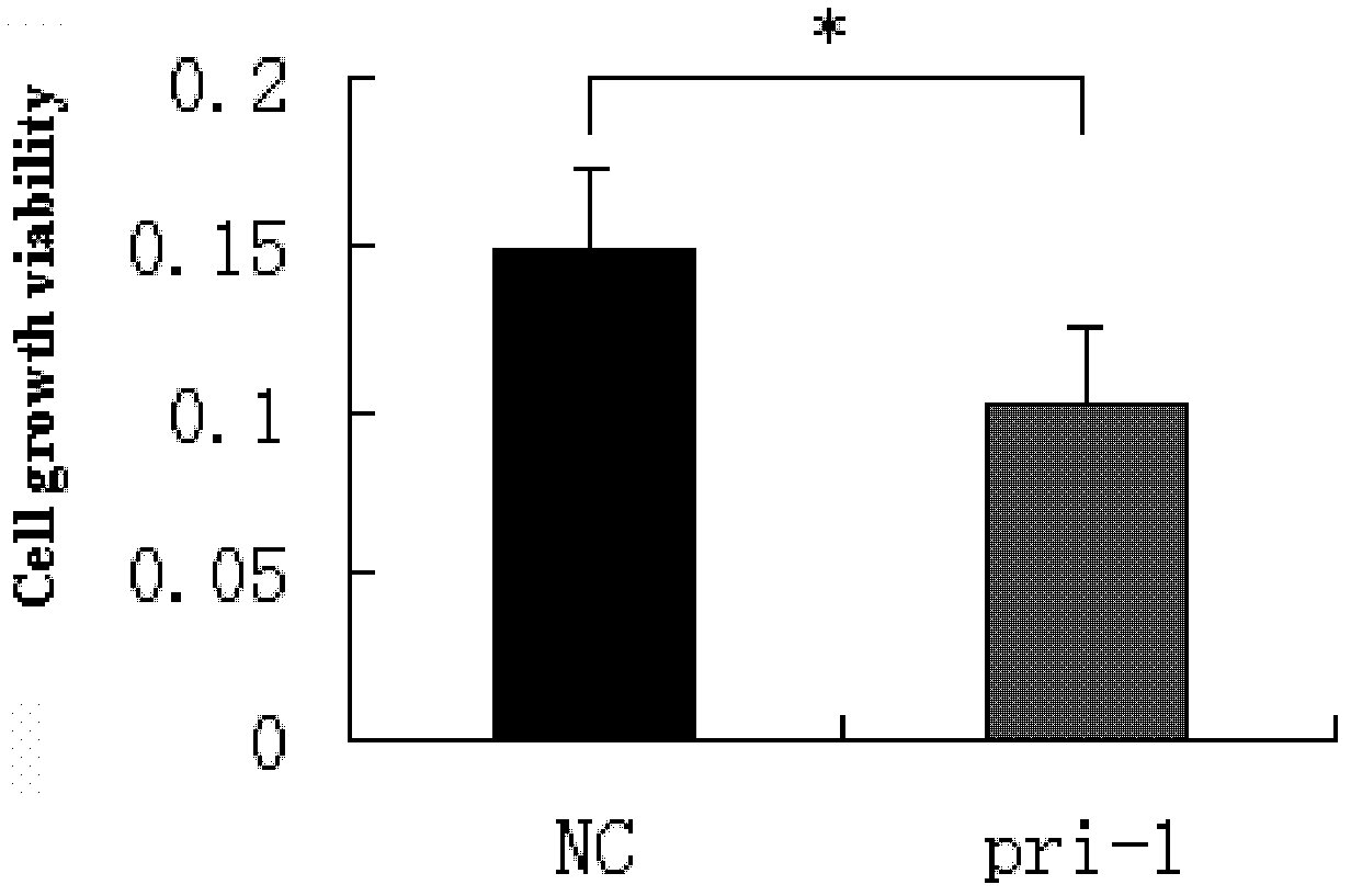 Application of miR-1 in production of preparation for treating primary glaucoma