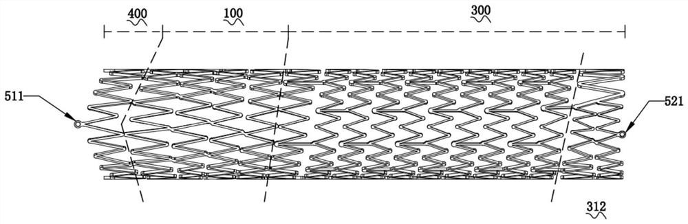 Self-expanding stent