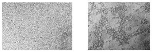 Antibacterial and antiviral porcine hemoglobin beta chain C-terminal fragment, bacillus subtilis expressing fragment, preparation and application