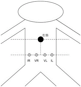 Real-time monitoring and automatic alarm method of low load bladder urine volume