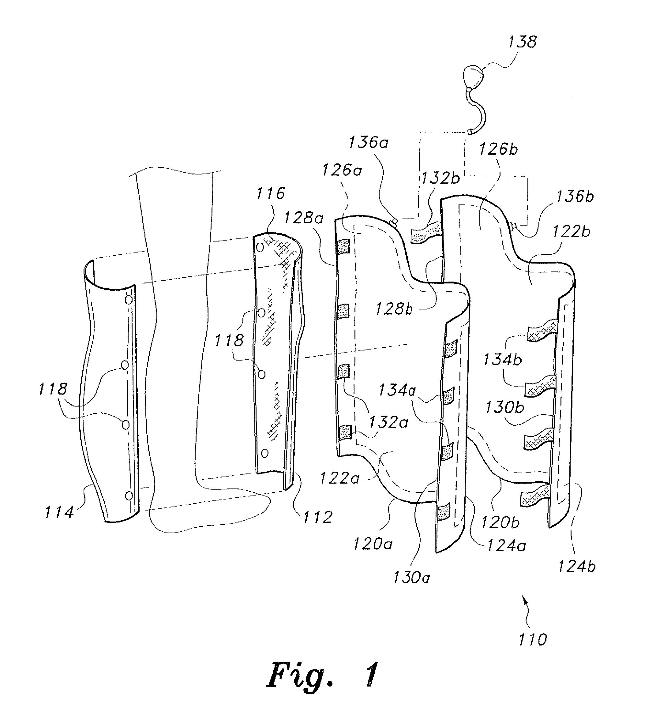 Inflatable splint