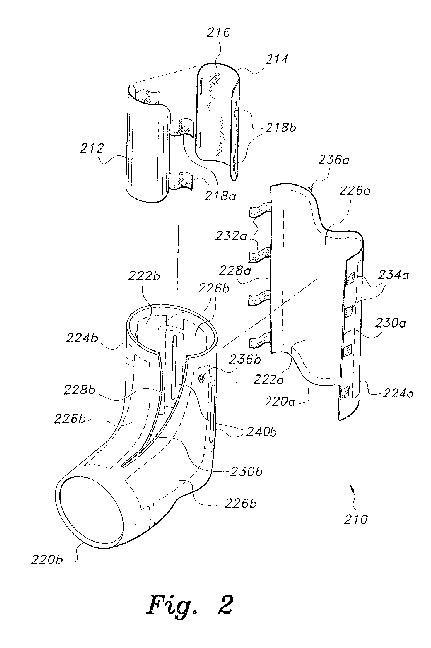 Inflatable splint