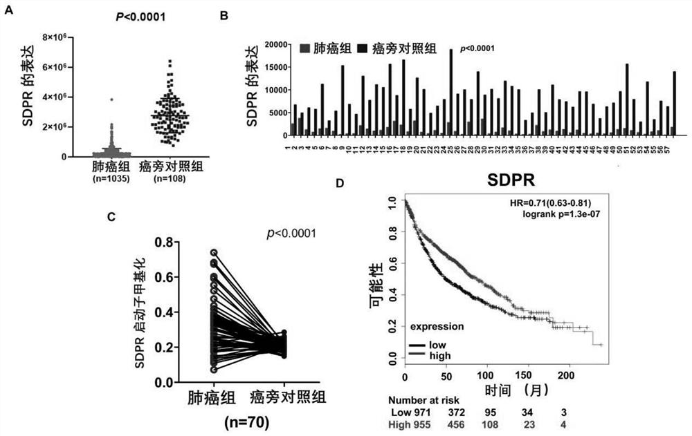 Detection kit for SDPR gene expression and/or SDPR gene methylation level and application