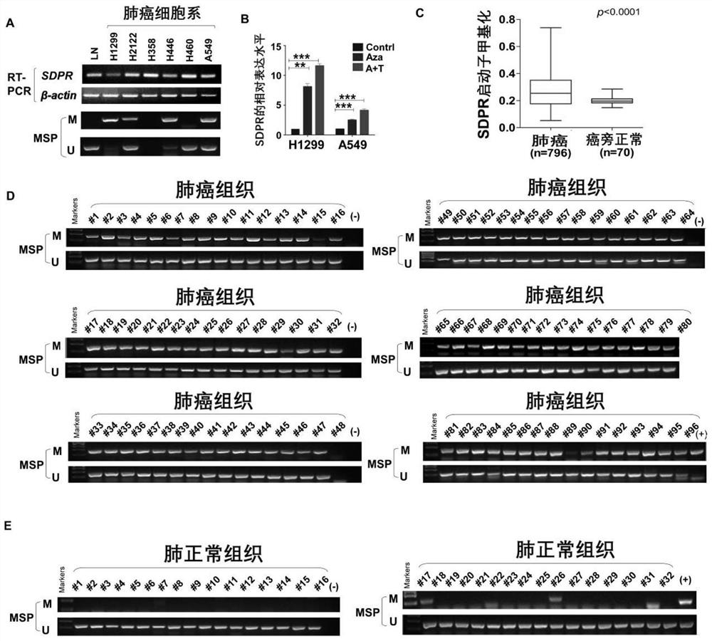 Detection kit for SDPR gene expression and/or SDPR gene methylation level and application