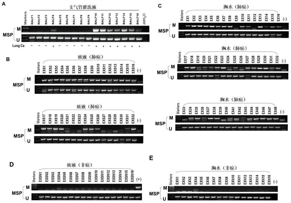 Detection kit for SDPR gene expression and/or SDPR gene methylation level and application