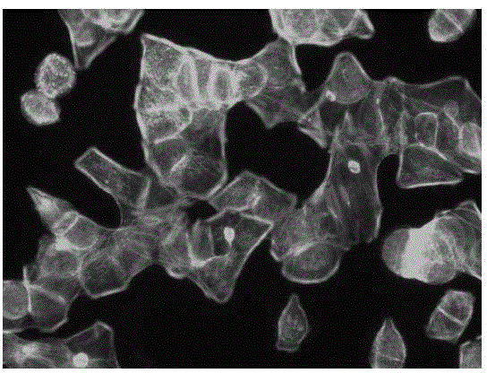 Application of betamethasone 17-valerate in preparation of medicines for inhibiting tumor cell metastasis and spread