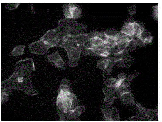 Application of betamethasone 17-valerate in preparation of medicines for inhibiting tumor cell metastasis and spread