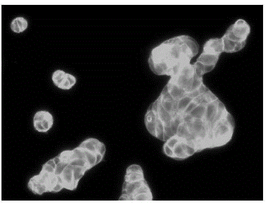 Application of betamethasone 17-valerate in preparation of medicines for inhibiting tumor cell metastasis and spread