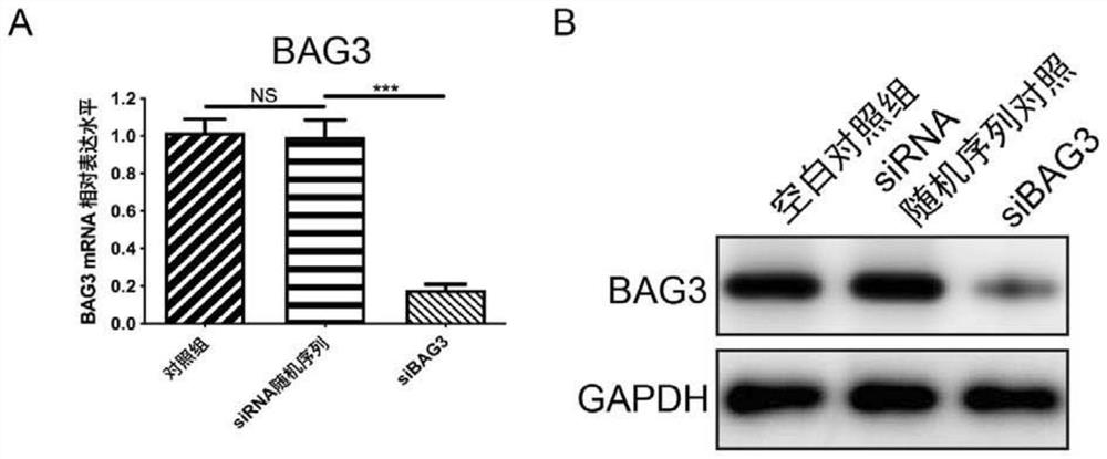 Application of BAG3 inhibitor in preparation of products for treating scars