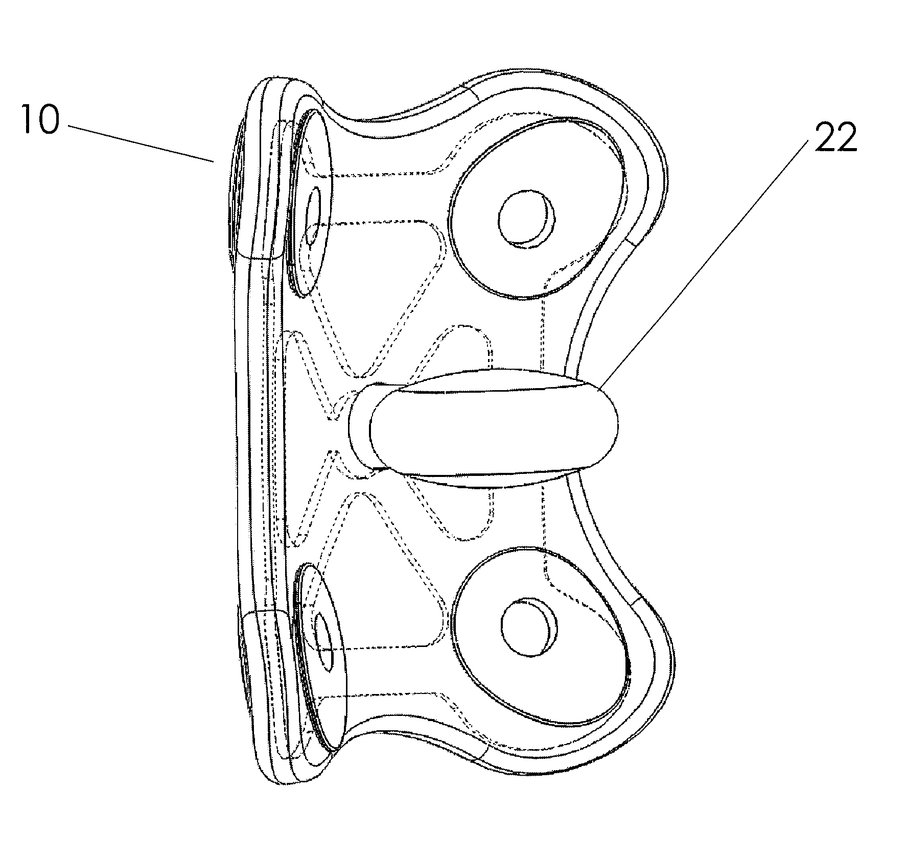 Anterior cervical disc replacement