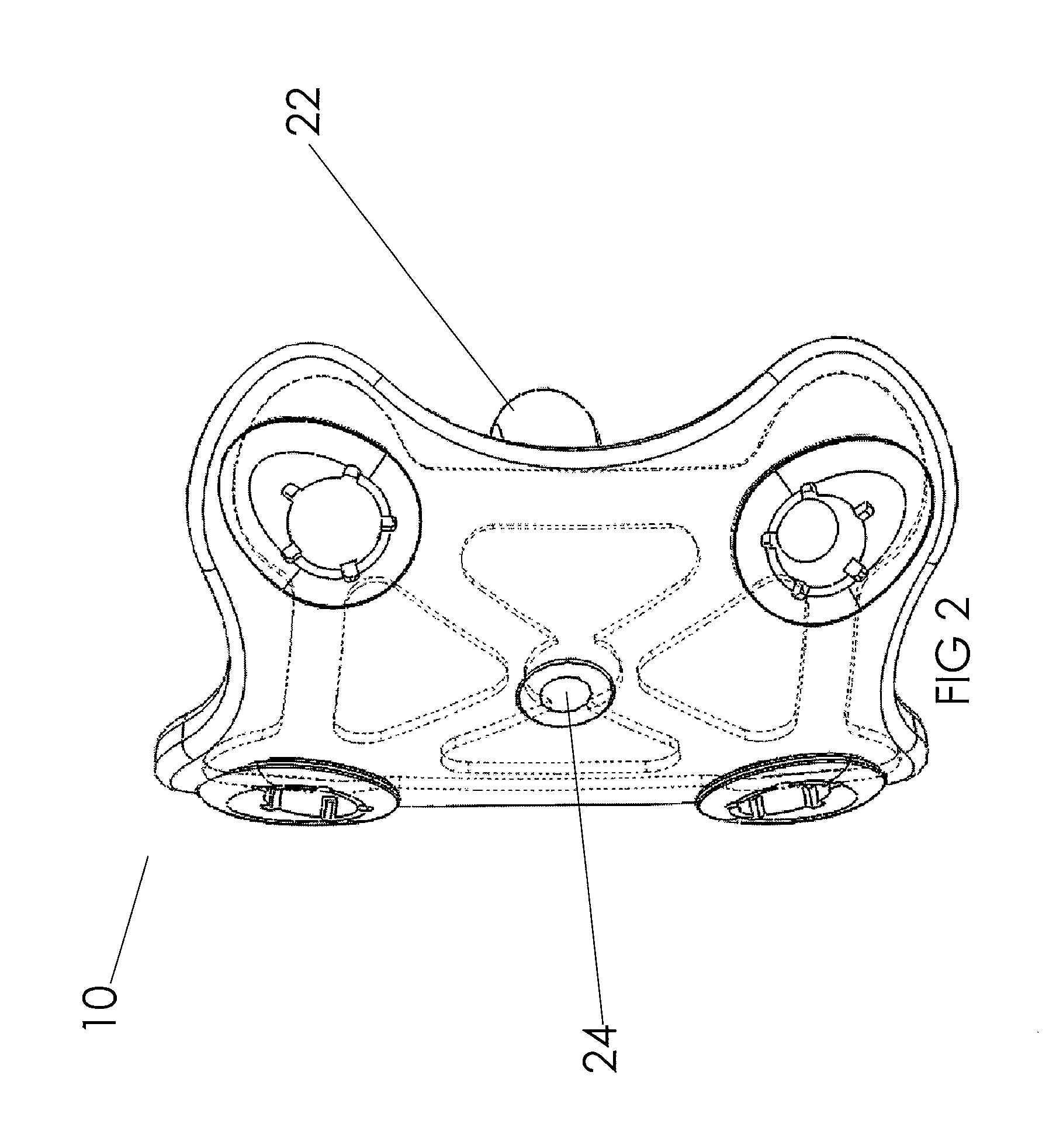 Anterior cervical disc replacement