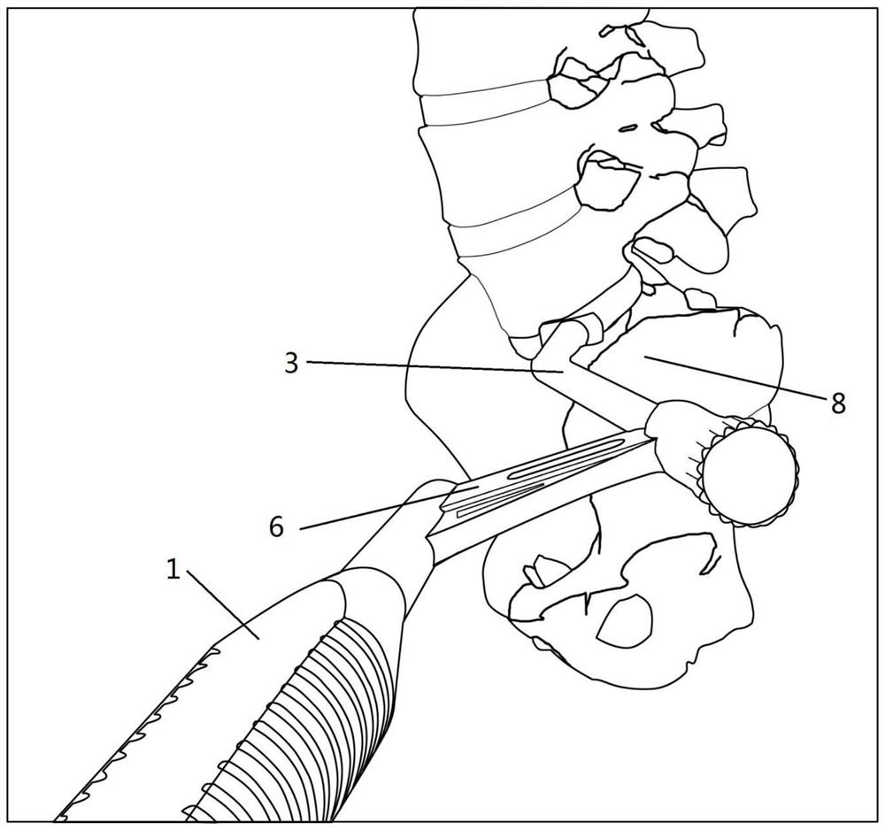 Fusion cage holding device