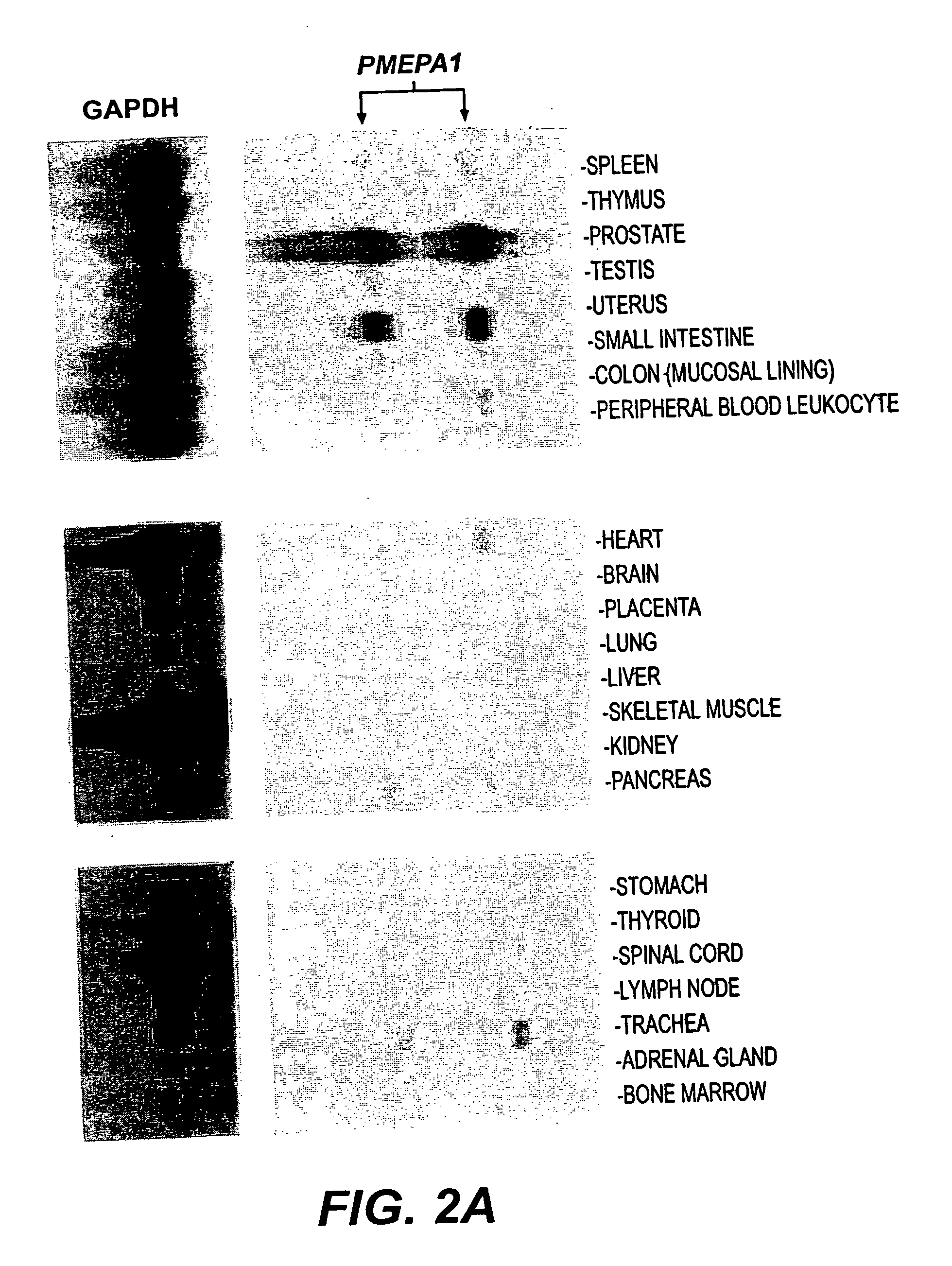 Androgen-regulated PMEPA1 gene and polypeptides