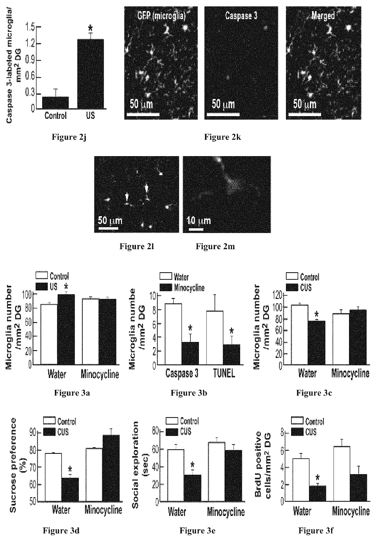 Treatment of mood and stress related disorders