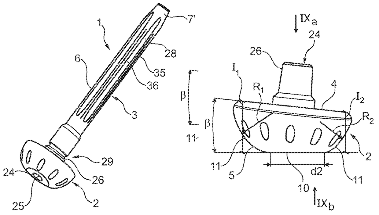 Implant for lower limb amputation