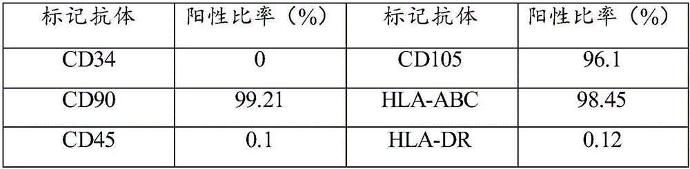 Umbilical cord mesenchymal stem cell injection liquid, preparation method and application thereof