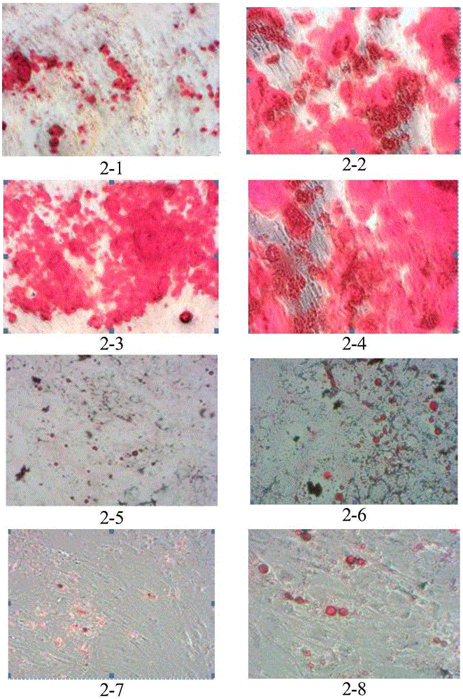 Umbilical cord mesenchymal stem cell injection liquid, preparation method and application thereof