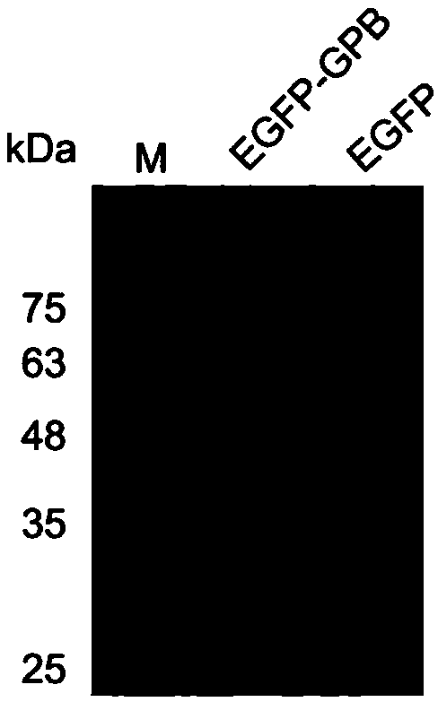 High-efficiency streptococcus pneumonia chimeric lyase and its mutant and application thereof